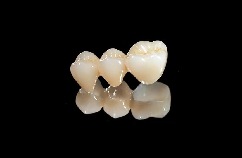 Zirconium Oxide restorations